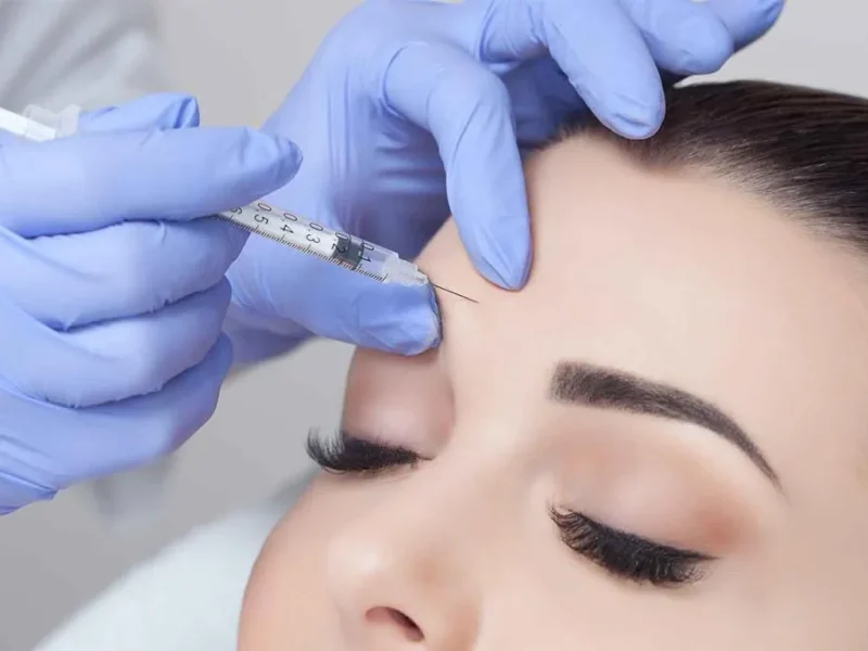 articulo-mesoterapia-facial